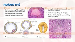hoàng thể hệ sinh dục nữ